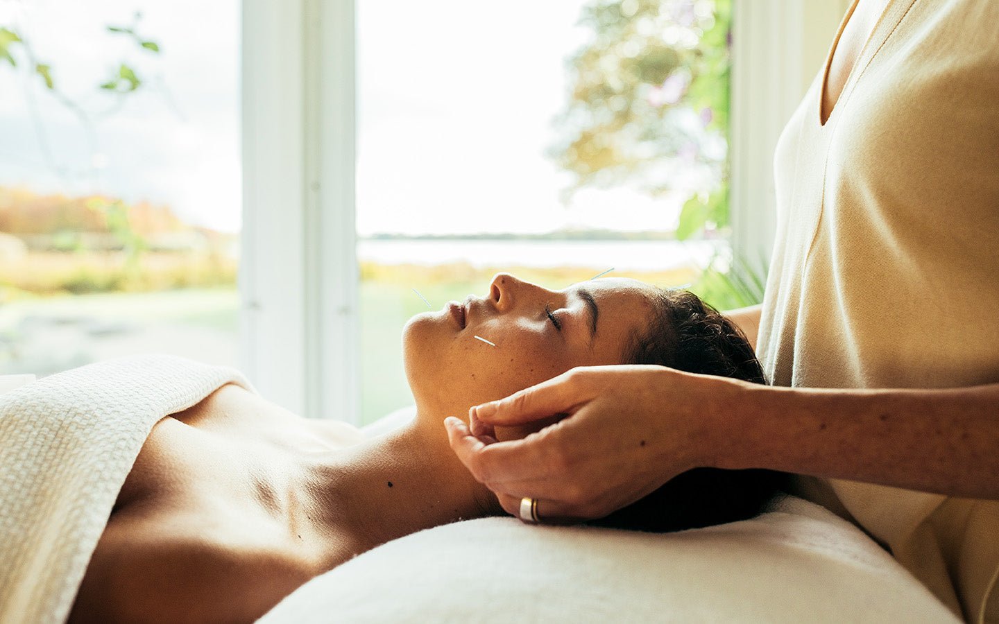 Woman receiving acupuncture on her face, lying on a white bed with a white blanket