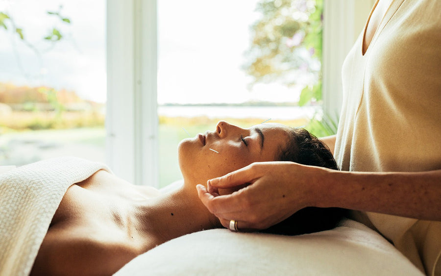 Woman receiving acupuncture on her face, lying on a white bed with a white blanket