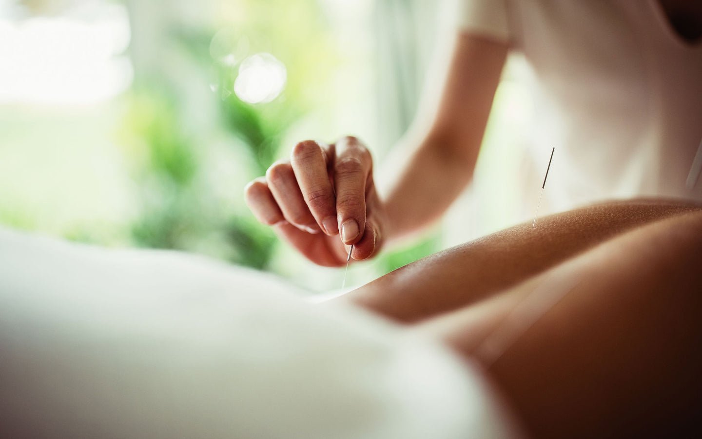 Acupuncturist inserting needles into a woman's arm with a blurred green background