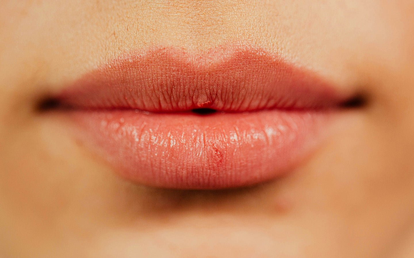 The Natural Playbook for Softer, Fuller Lips